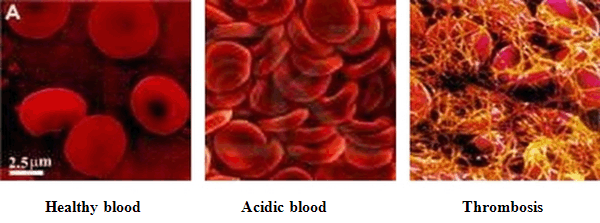 sangue-alkalino-acido
